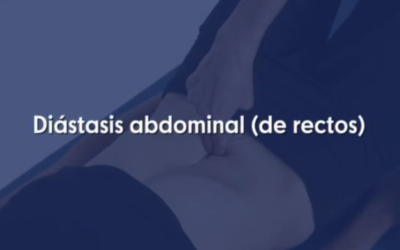 Distiasis abdominal (de rectos)