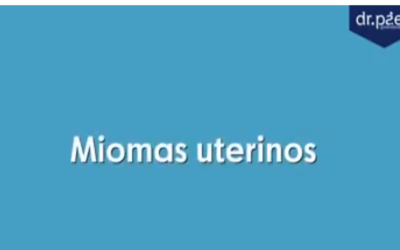 Miomas uterinos